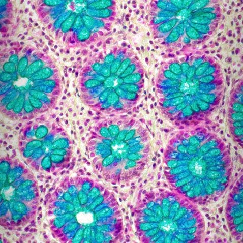 Células caliciformes del colon/intestino grueso