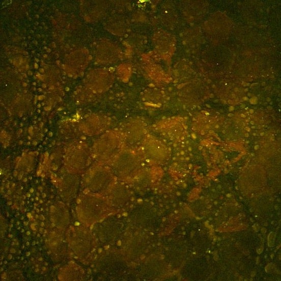 Imagen de piel de ratón por espectroscopía Raman estimulada