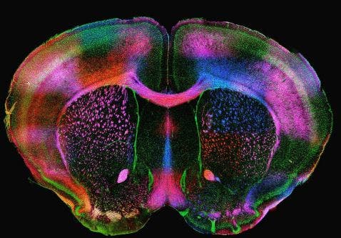 Imagen de microscopio de un cerebro de ratón expresando proteínas de mielina