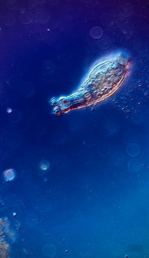 Rotífero bdeloideo bajo el microscopio