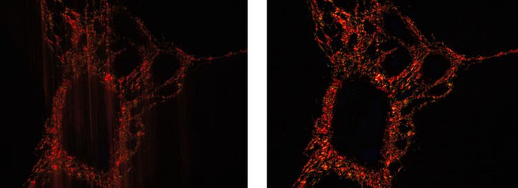 Imágenes suavizadas en vivo en microscopía