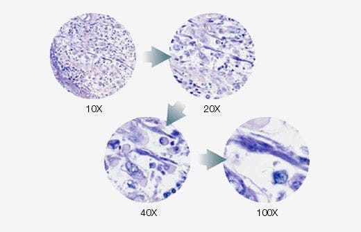 Ejemplo del regulador de intensidad de luz del microscopio BX46: ajuste automático del brillo en diversas magnificaciones para evitar el ajuste manual