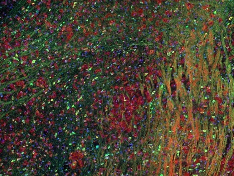 Fluorescence imaging of a mouse brain