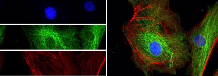 Microscopio de fluorescencia fácil para el procesamiento de imágenes multicanal