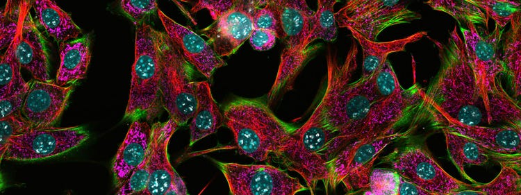 Capturas de la misma imagen través de tres configuraciones distintas de estenopo.