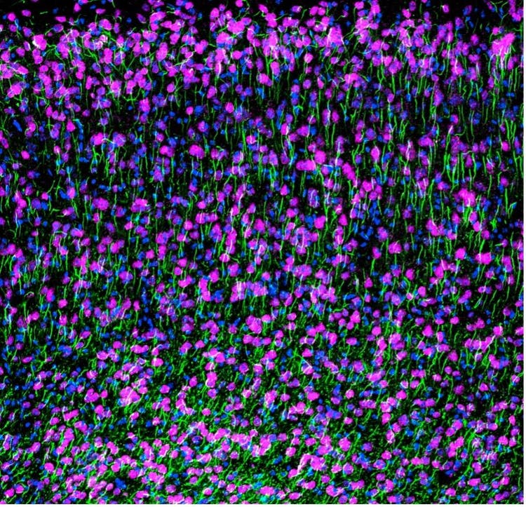 Imagen confocal del córtex teñido de un ratón