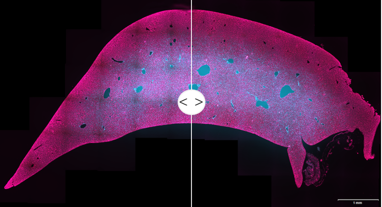 Stitched image of rat liver tissue with intelligent shading correction applied on the right.