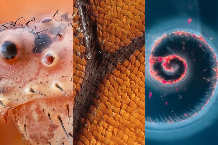 Imagen microscópica