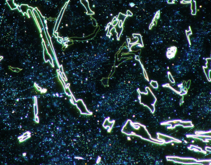 Imagen de campo oscuro de una aleación pulida de aluminio-silicio.