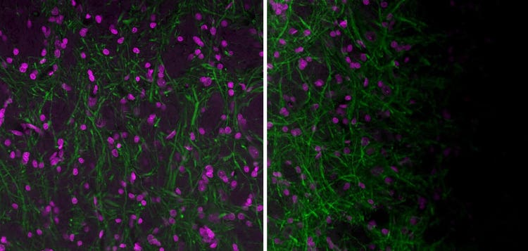 Artefactos de sombreado en imágenes capturadas por un microscopio confocal