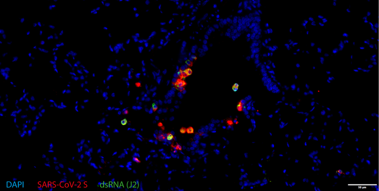 Double-stranded RNA and SARS-CoV-2 spike protein expression in hamster tissue, imaged with the SLIDEVIEW VS200 slide scanner.