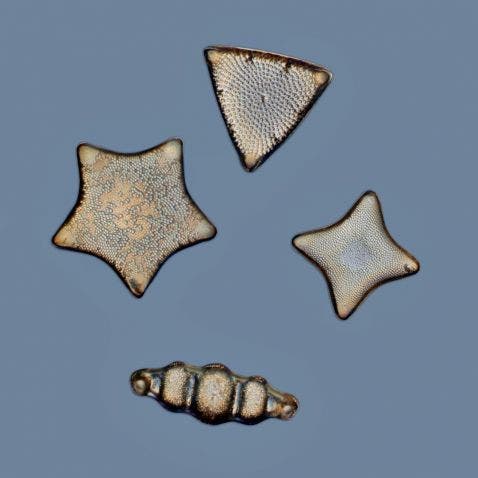 Arreglo de diatomeas bajo el microscopio