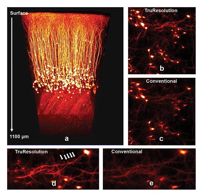 Procesamiento de imágenes profundas in vivo de espinas dendríticas