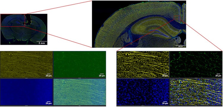 Imagen de portaobjetos completo de la sección cerebral de un ratón