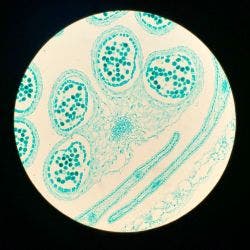 Flor de colza bajo el microscopio.