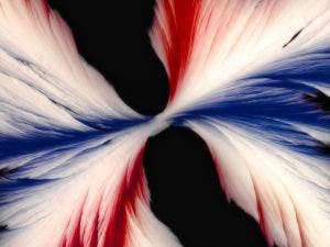 Cristales de fenilbutirato de sodio (Ammonaps) bajo el microscopio