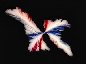 Cristales de fenilbutirato de sodio (Ammonaps) bajo el microscopio