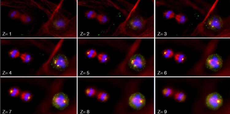 Adquisición de imágenes con apilamiento en Z usando un microscopio de fácil uso