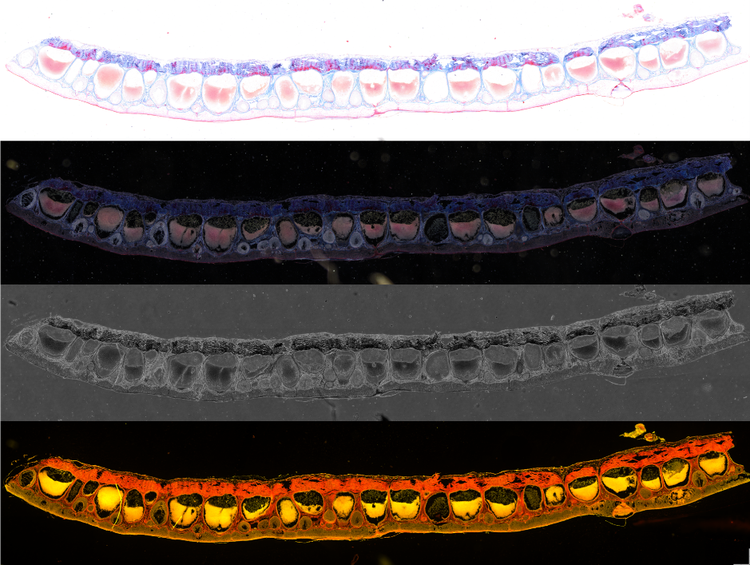 A collage of different colored cells AI-generated content may be incorrect.