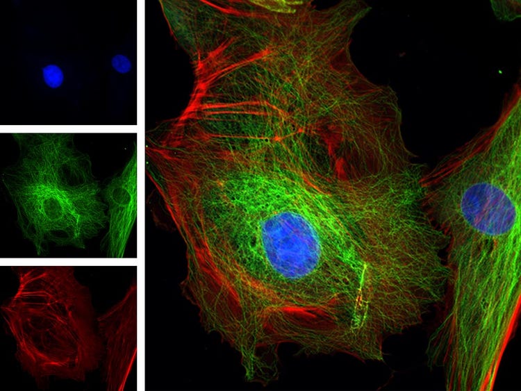 Fluorescencia multicanal