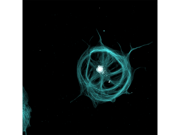 Imagen aplicativa de tubulina y el núcleo de células BSC-1