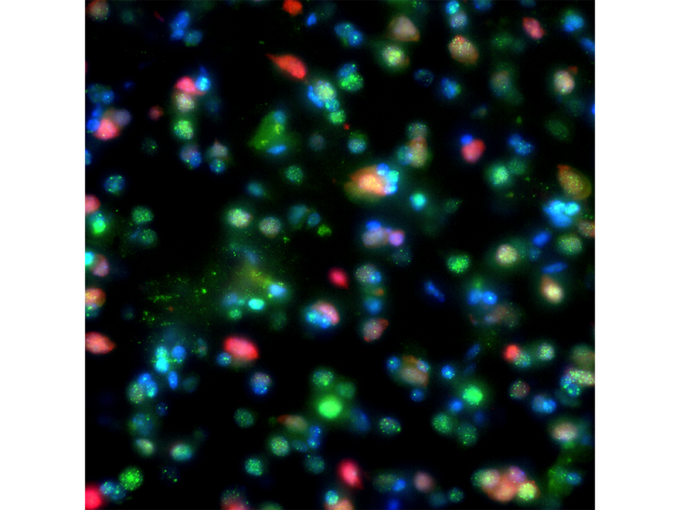 Imagen de aplicación de colocalización de NeuN y γ-H2AX en un cerebro de mono