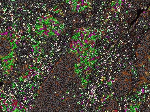 Visiopharm Analysis Software