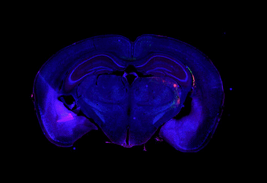 ホールスライドイメージング