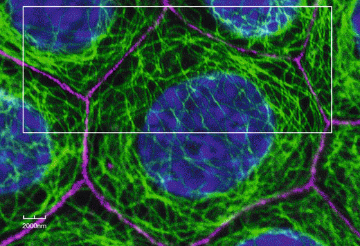 共焦点/超解像/ライブセル 蛍光イメージング