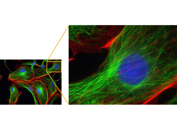 Planitud de imagen mejorada