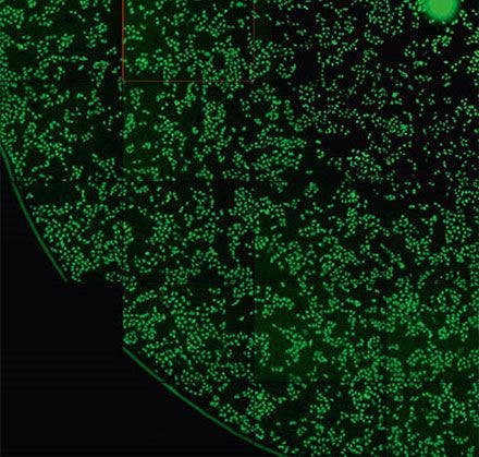 Figure 6 GFP channel of the region shown in Figure 2.