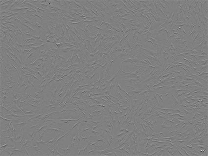 Figura 4. Recuento celular. El núcleo de la célula se marca de color azul