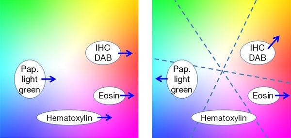 Figure 5 – With traditional color adjustment, (left) red enhancement for eosin affects all other stains, whereas multiaxis color adjustment (right) enables independent optimization of colors for each stain