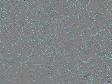 Figura 4. Recuento celular. El núcleo de la célula se marca de color azul