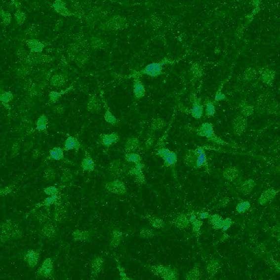 Calcium imaging: chemical indicator Fluo-3 in neuronal cells.
