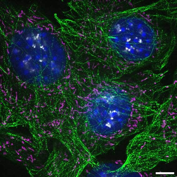 NIH3T3 cells labeled with Hoechst (blue), β-tubulin–AF555 (green), CPCA–HSP60–AF647 (magenta), and fibrillarin–AF568 (gray). Scale bar: 5 µm. Sample courtesy of EnCor Biotechnology Inc.