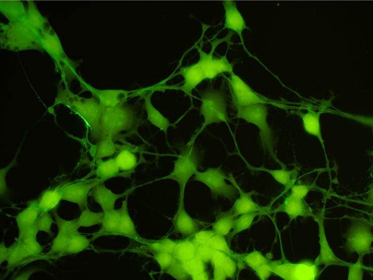 Fluorescence image captured using high contrast mode