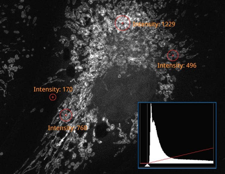 Detector convencional