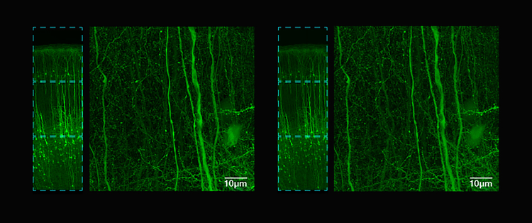 Comparison images showing images captured with the FV5000’s galvo (left) and resonant (right) scanners, highlighting that you can acquire up to nine times faster than galvo with the same stunning clarity.