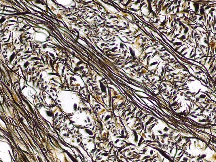 Specimen: Cerebellum (Golgi (silver) staining); Microscope: CX23, Objective: Plan Achromat 40x (NA 0.65), TV-Adaptor: U-TV0.5XC-3, Illumination: Brightfield (LED), Exposure time: 13.5 ms