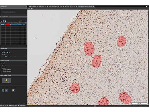 Proceso de trabajo sencillo para detectar y segmentar muestras automáticamente mediante el deep learning