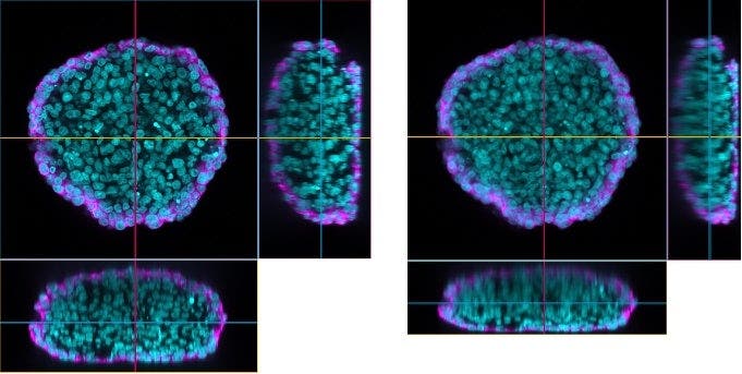 Comparación de imágenes XYZ entre una lente de objetivo en gel de silicona LUPLAPO25XS (izq.) y una lente de objetivo en seco UPLXAPO20X (dcha.). Esferoide de células HeLa* aclarado (cian: núcleo; magenta: microtúbulos). Para obtener más información sobre el origen de las células HeLa, visite henriettalacksfoundation.org.
