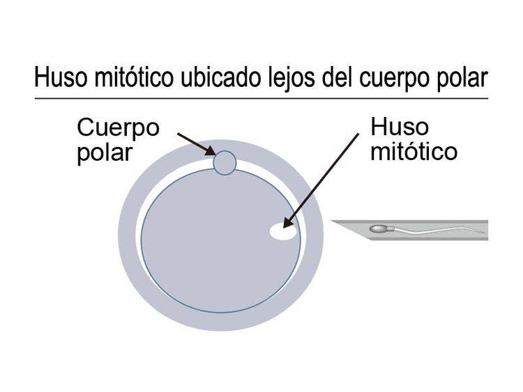 Huso mitótico ubicado lejos del cuerpo polar