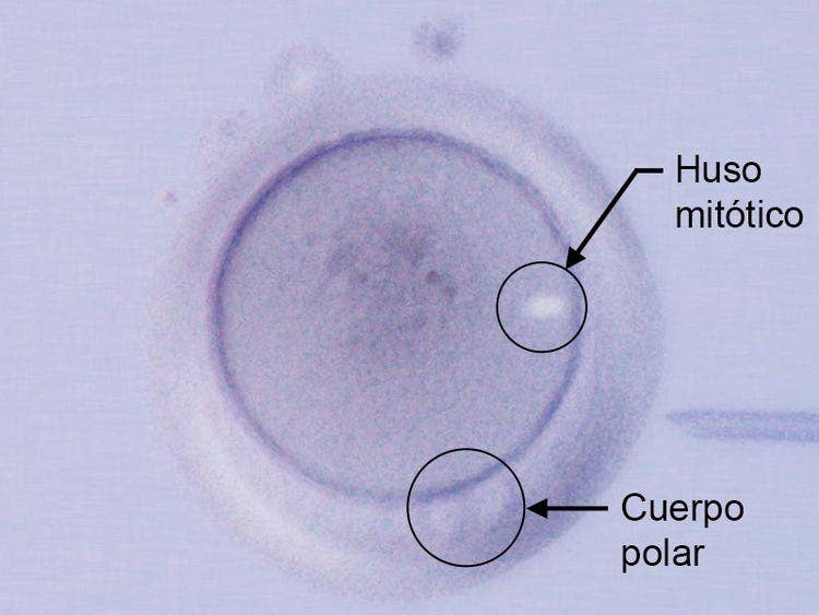 Huso mitótico / Cuerpo polar