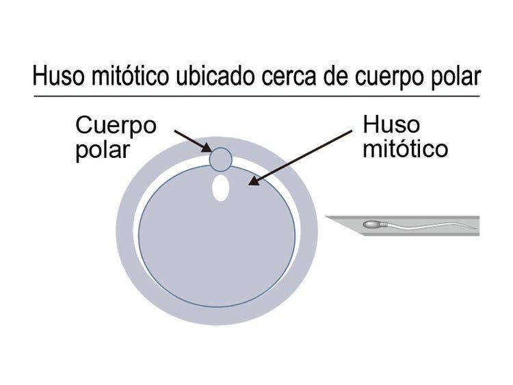 Huso mitótico ubicado cerca de cuerpo polar
