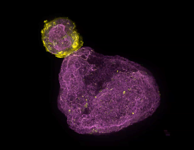 Orgánulo (organoide). Faloidina (magenta). E-cadherina (amarillo).