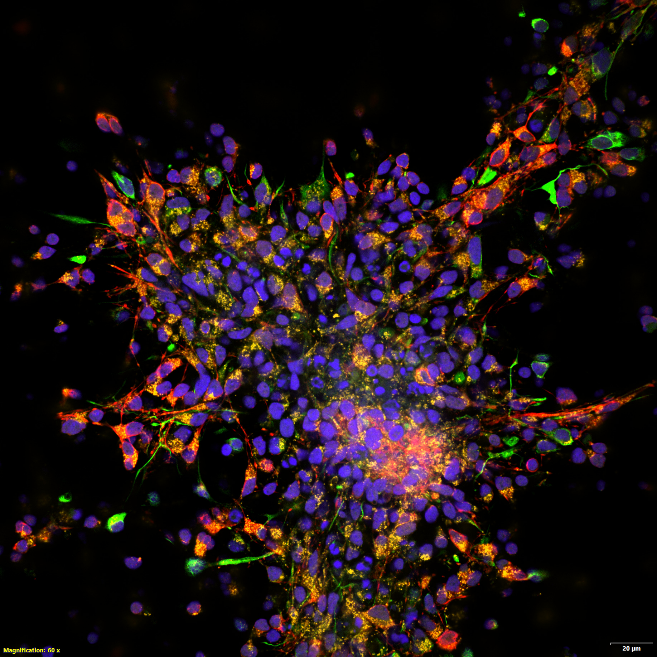 Neuronas. DAPI (azul), ATP5 (amarillo), vimentina (rojo), MAP2 (verde).