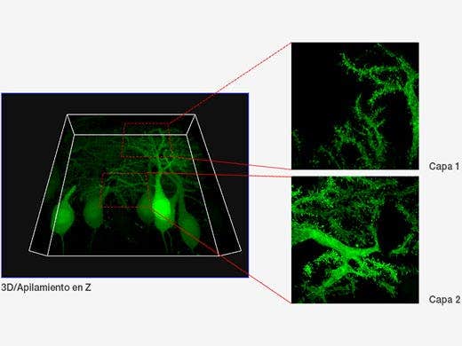 Células Purkinje marcadas con GFP. Imagen XYZ con imagen confocal y de súper resolución en diferentes posiciones Z. Las imágenes con súper resolución son proyectadas por Z (10 cortes). Imagen 3D mostrada por FV31S-DT.