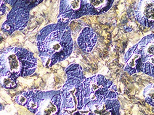 Contraste de interferencia diferencial (DIC)