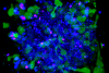 Procesamiento de imágenes de intervalo de tiempo en 3D de esferoides con el microscopio confocal FLUOVIEW FV3000: Observación continuada durante 48 horas de la citotoxicidad mediada por células dependientes de anticuerpos (ADCC)